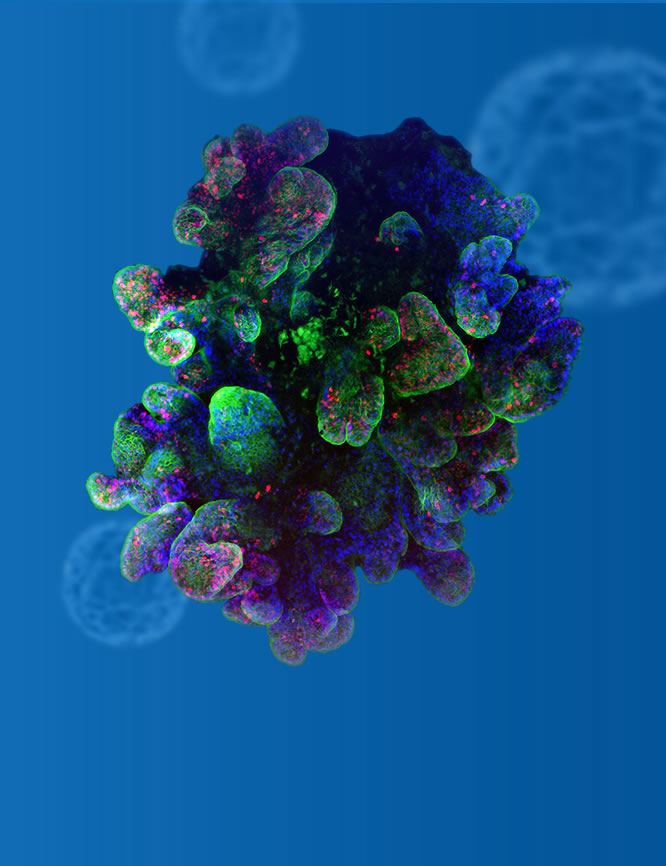 消化道肿瘤器官芯片